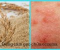 Cách dùng cám gạo chữa bệnh eczema đơn giản tại nhà