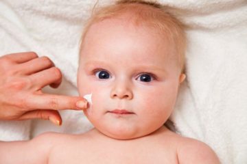 Trẻ sơ sinh bị chàm nên bôi thuốc gì? Tư vấn